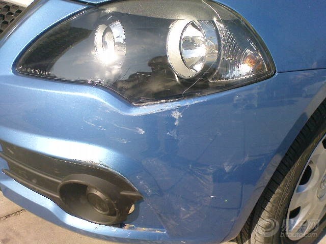 【我是真的受伤了,还没来及得瑟,就出事儿了】