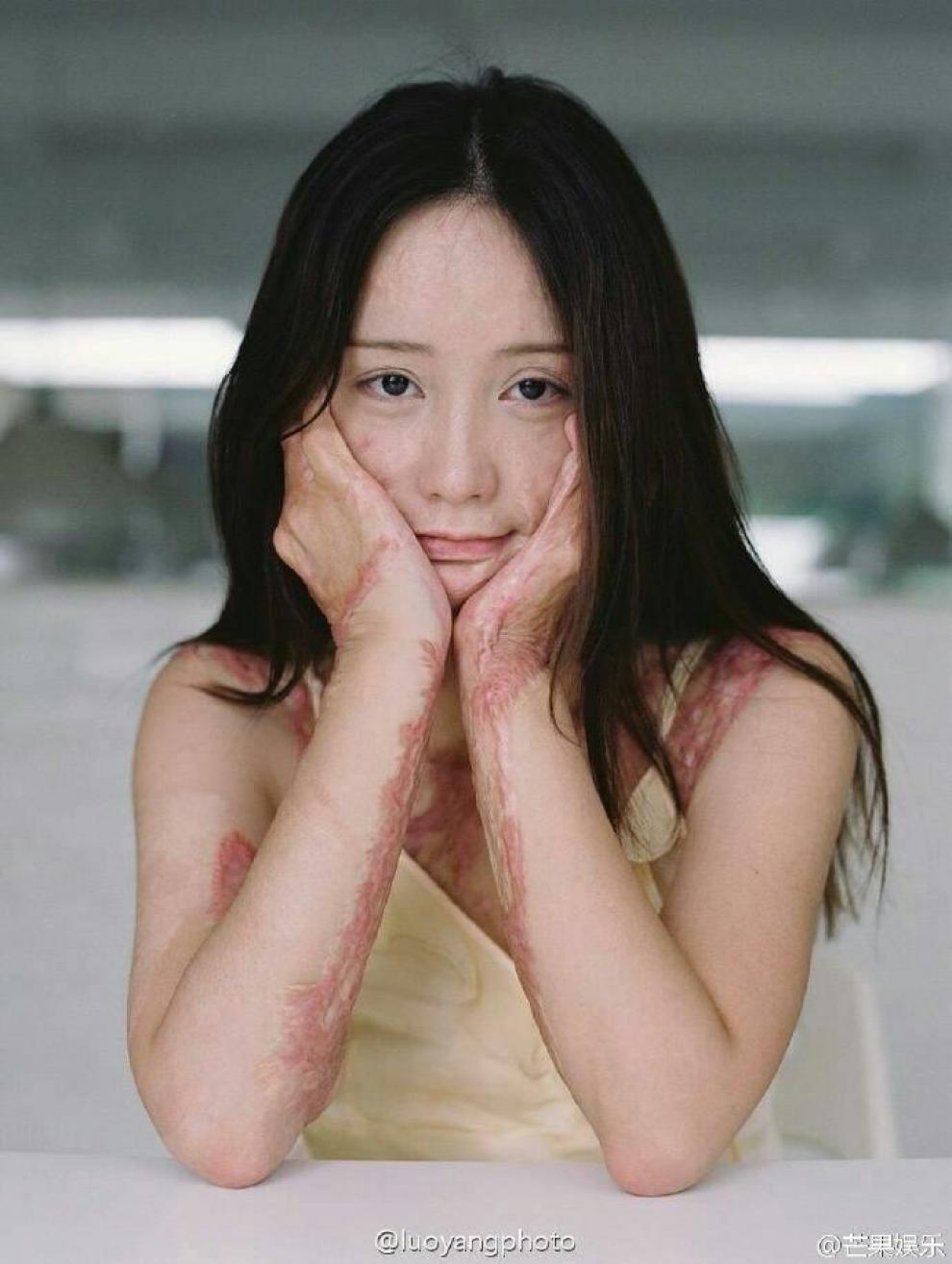 鹏鹏#每天一推送# 她曾被官二代泼汽油点.