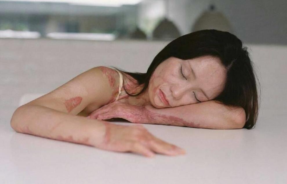 鹏鹏#每天一推送# 她曾被官二代泼汽油点.